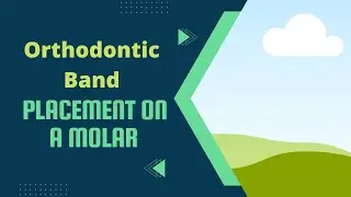 Simple Technique for Placement of Orthodontic Band on a Molar..!!