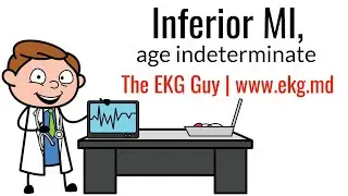 Inferior MI (age indeterminate) on EKG / ECG l The EKG Guy - www.ekg.md