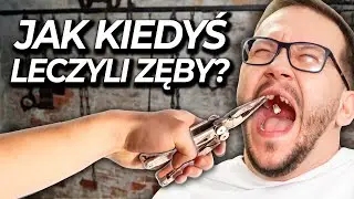 Jak Leczono Zęby w Średniowieczu?