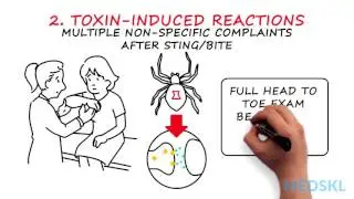 Emergency Medicine &ndash; Insect Stings and Bites: By Dersim Kaya M.D. & Abbas Husain M.D.