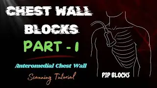 Parasternal Intercostal Plane Blocks | Chest Wall Blocks | PIP Blocks | Master Class