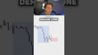Waarom de meesten traders falen 📉 #forex #crypto #investeren