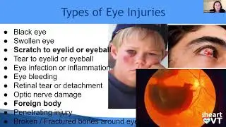 I HEART VT: Q&A with Dr. Tamara Petrosyan - Head and Eye Injuries in Children