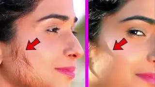 How to Remove Unwanted Facial Hair Naturally: 100% Results