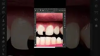 Easily Fix Teeth in Photoshop 🔵  #pixinshop #satyendrasutrakar #photoshop #photoshoptutorial