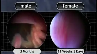 The Biology of Prenatal Development: 11 weeks