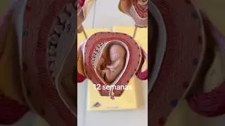 12 semanas. #medicina #ecografia #bebe #ginecologia #obstetricia #embarazofeliz