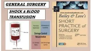 Shock & fluid resuscitation & monitoring - From Bailey & love (General surgery) #surgery #lecture