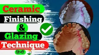 Finishing & Glazing Technique| (full tutorial video) Ceramic Finishing| Glazing| Dental Video | Lab