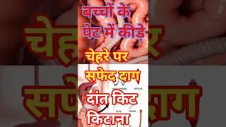बच्चों के पेट में कीड़े, चेहरे पर सफेद दाग, सोते में दांत किटकिटाना