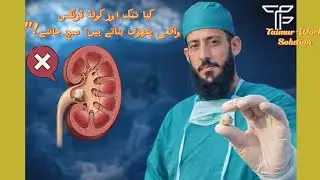 Kidney Stone Complete Details #3D Animation Urdu #kidneyhealth #kidneydisease #UrduMedical