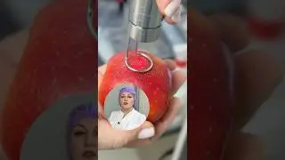 СО2 лазер в гинекологи. Кому мы рекомендуем эту процедуру...