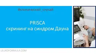 1. PRISCA - пренатальный скрининг I триместра.