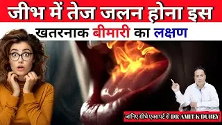 जीभ में तेज जलन। Burning Mouth Syndrome symptoms , क्या है बचाव। Dr Amit k Dubey