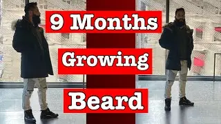I let it grow my beard for 9 MONTHS!! | Fue beard transplant
