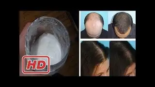 [Healthy Life]How to Make Baking Soda Shampoo For Hair Growth | Natural Home Remedy