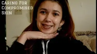 Caring For Compromised Skin | Alexis Danielle