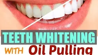 TOP SECRET FOR WHITE TEETH: Oil Pulling  |SolutionsRoom|