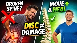Disc Prolapse Is Not a Broken Spine | Why Movement Beats Fear
