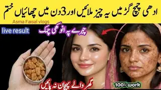 How to get rid of pigmented skin, how to remove pigmentation, best remedy for removing pigmentation