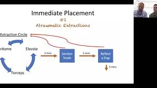 Immediate Placement and Immediate Load