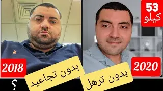 خسرت 50 كيلو ! كيف حافظت على وجهي بدون ترهلات ؟ اسباب نحافه الوجه بعد فقدان الوزن ؟