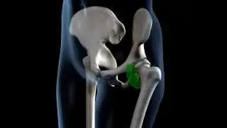 Hip Joint Range of Movement - 3D Medical Animation || ABP &copy;