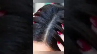 how to reduce dandruff #shorts #hair #haircare #haircaretips