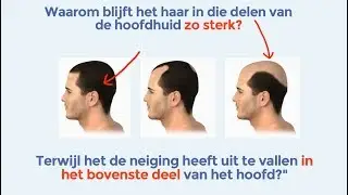 Nieuwe Haaruitval behandeling 2018 - Kies het beste voor je haar! Behandeling voor mannen en vrouwen