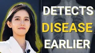 This Blood Test Predicts Disease Years Before Symptoms | Interview With Alina Su