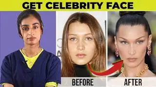 The truth about buccal fat removal? Hit or Miss? Dr. Hirra Alavi