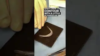 Chin Implant Surgery
