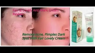 Remove Spots, Acne Scars, Pimples With Fair & Lovely Anti Marks Creaam