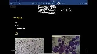 CML 2