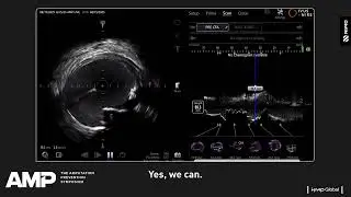 Makoto IVUS Imaging at AMP Chicago | High-Resolution View of the Common Femoral Artery