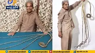 World Longest Fingernails Man | Sridhar chillara to Remove His Nails | in America