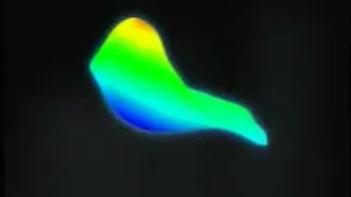 LASIK Wavefront Measurement for the Excimer Laser - Eye Associates of CO Springs