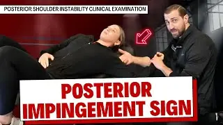 Posterior Impingement Sign  | Posterior Shoulder Instability Clinical Examination