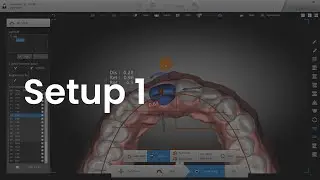 4. Setup - Baseline setting & Tooth contorl & IPR