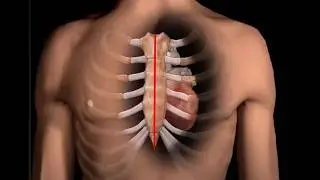 Central Venous Catheter Insertion Animation | PICC Line