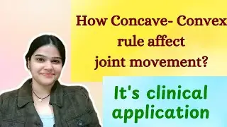 Clear concept for concave-convex rule - how and where it is used?