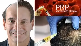 best treatment for hair regrowth