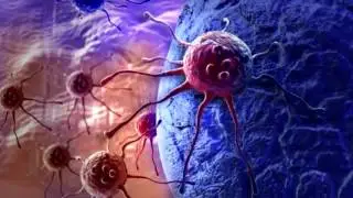 The Big Idea EXTRA: Evolution of Cancer