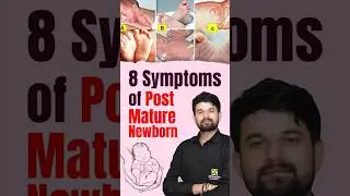 8 Symptoms of Post Mature Newborn #shorts #utkarshnursing #sagarsir