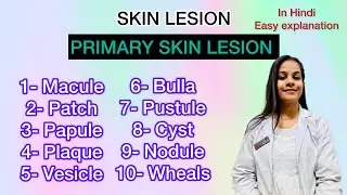 primary skin lesions lecture in Hindi with easy explanation