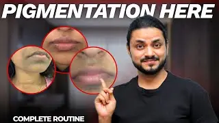 Pigmentation Around Mouth? Do THIS Instead of Random Creams 