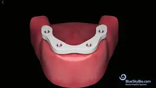 Trilor&reg;