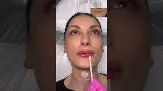 Gorgeous lips for this gorgeous girl ❤️👄