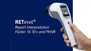 Interpretation of the RETeval Flicker 16 Tds and PhNR test reports