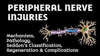 Peripheral Nerve Injuries | Mechanism, Pathology, Seddon&rsquo;s Classification & Regeneration | Dr Saroj